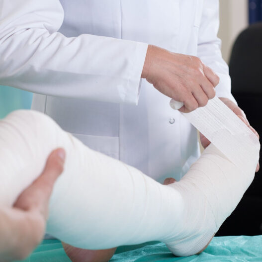 Image of a broken leg in need of a los angeles truck accident lawyer