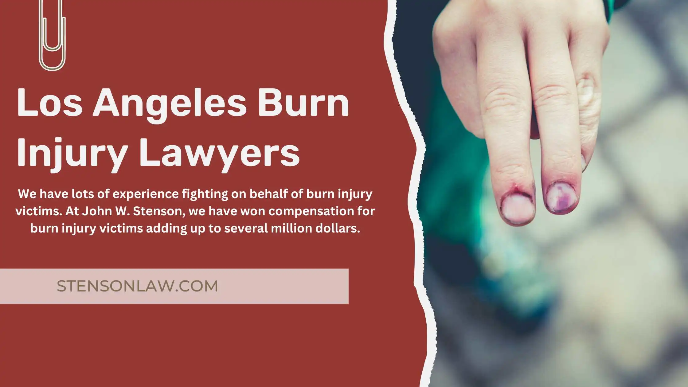 Los Angeles Burn Injury Lawyers